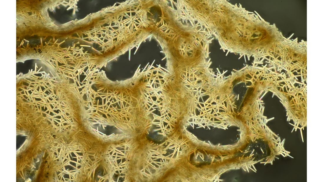 Clathrina coriacea | Spicule