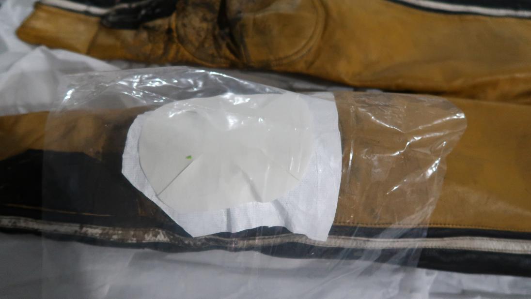 A close up of the knee of a yellow and black jumpsuit with a piece of white cloth over it. Over the cloth is a smaller piece of white cloth. Over that is a sheet of plastic.