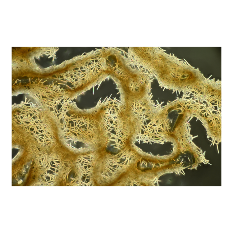 Clathrina coriacea | Spicule